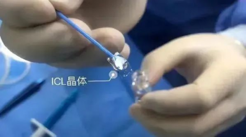 變身謠言“粉碎機”！濰坊眼科醫(yī)院員工集體ICL晶體植入摘鏡直播圓滿完成
