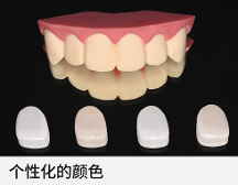 極薄強(qiáng)韌氧化鋯貼面技術(shù)，一款免磨牙貼面技術(shù)